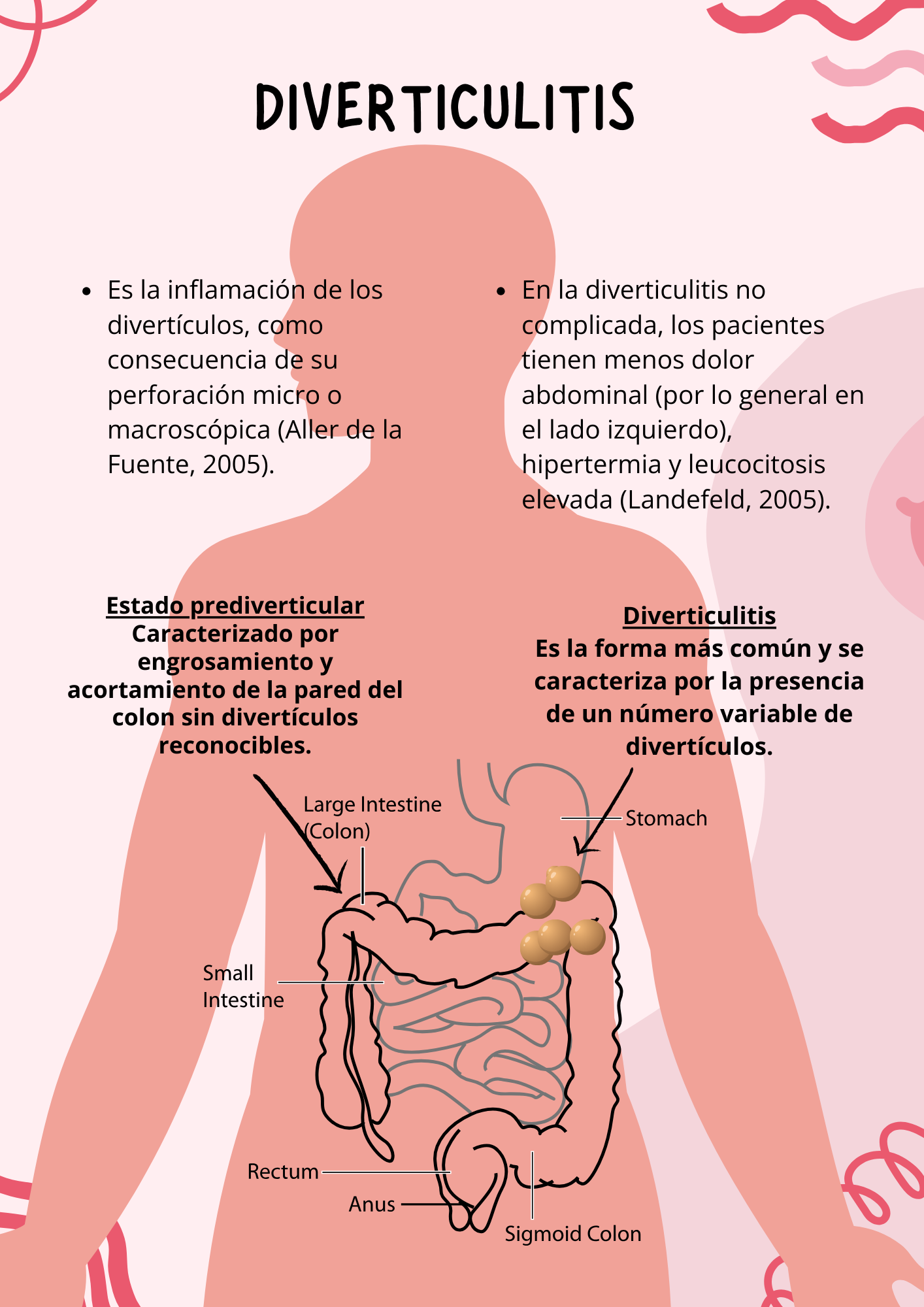 Gráfico que representa los síntomas de la enfermedad diverticular