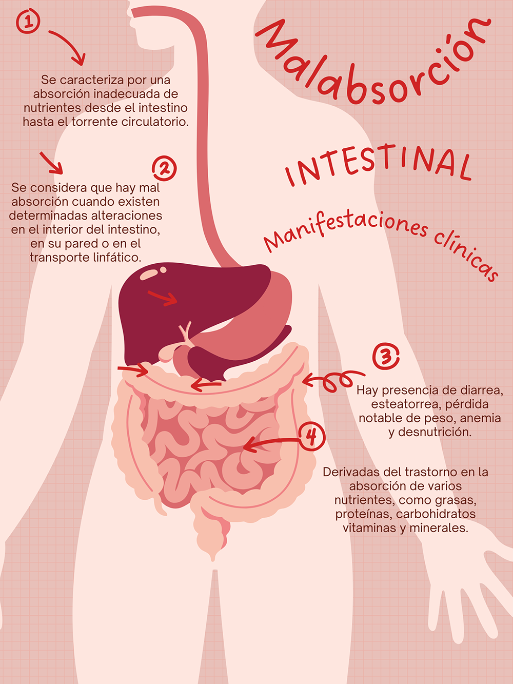 Infografía donde se muestran las características y manifestaciones clínicas de la malabsorción intestinal